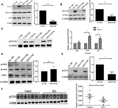 SEC5 is involved in M2 polarization of macrophages via the STAT6 pathway, and its dysfunction in decidual macrophages is associated with recurrent spontaneous abortion